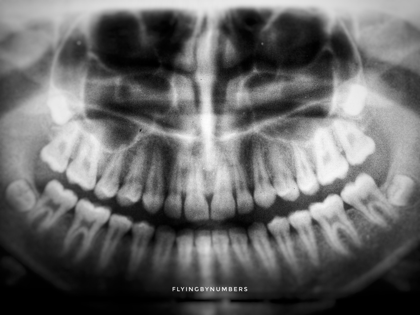 Dental x ray emirates